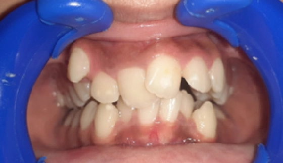 Before dental transformation 12