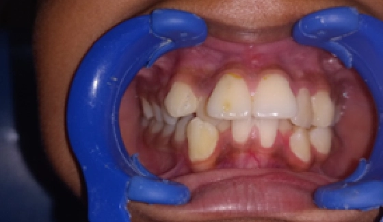 Before dental transformation 13