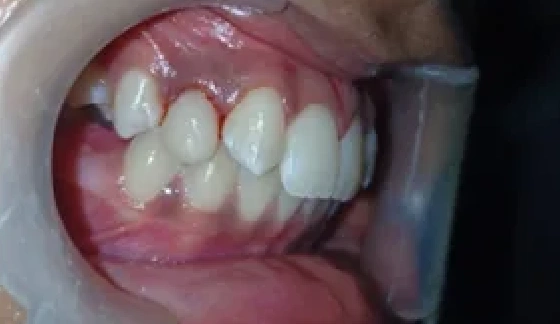 After dental transformation 17