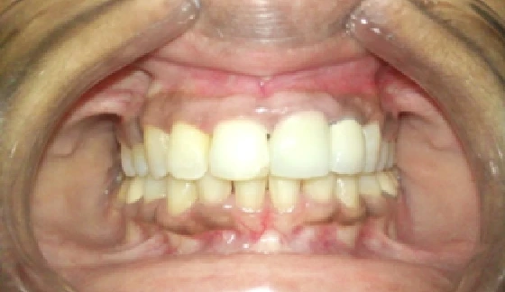 After dental transformation 10