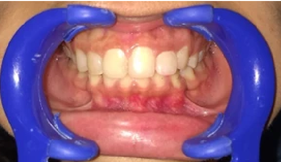 After dental transformation 7