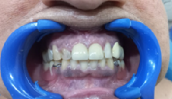 After dental transformation 8