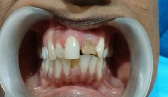 Before dental transformation 9