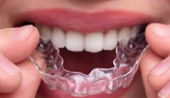 Mouth Guard