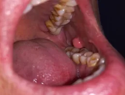 Before dental transformation 4
